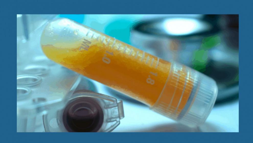 Regeneraci�n de tejidos con Lipogems - Foto